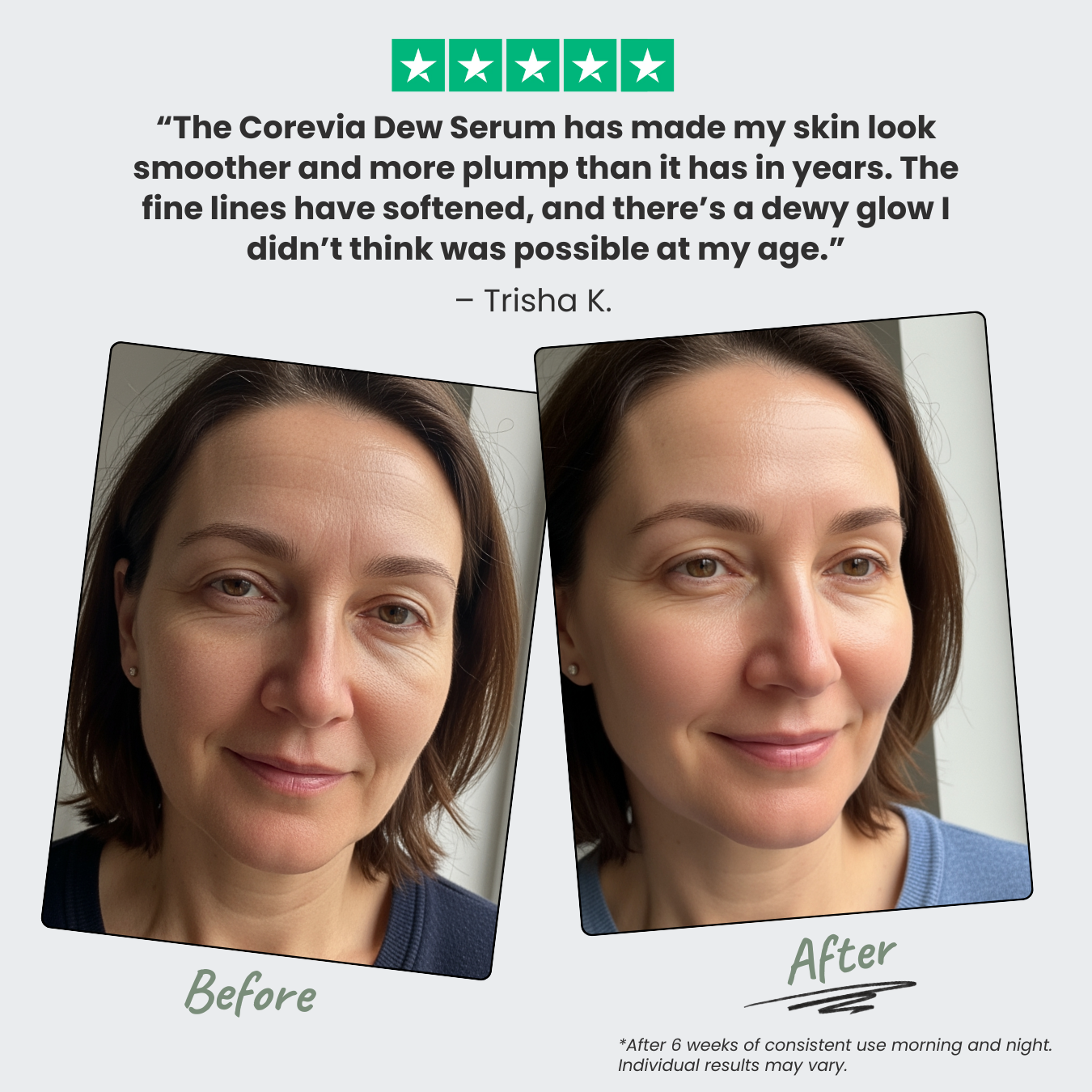 Dew Serum with Multi-Weight Hyaluronic Acid